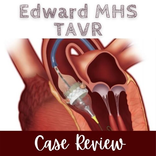 2021 EDW MHS TAVR Case Review (RSS) Banner